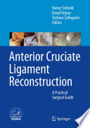 Anterior cruciate ligament reconstruction : A practical surgical guide.