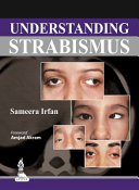 Understanding strabismus /